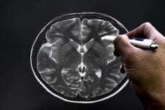 Мягкое и расплывчатое изображение: Мозг MRI пациента и руки ` s доктора проверяют размер стоковые фотографии rf Мягкое и расплывчатое изображение: Мозг MRI пациента и руки ` s доктора проверяют размер стоковые фотографии rf