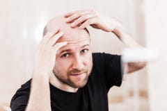 Облыселый человек смотря зеркало на головных плешивости и выпадении волос стоковые фотографии rf Облыселый человек смотря зеркало на головных плешивости и выпадении волос стоковые фотографии rf