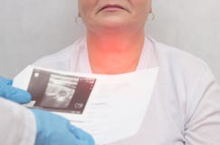 Пациент на докторе с заболеванием тиреоида узелкового зоба, конец-вверх, медицинский, воспаление стоковые изображения rf Пациент на докторе с заболеванием тиреоида узелкового зоба, конец-вверх, медицинский, воспаление стоковые изображения rf