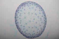 Поперечное сечение Dicot, Monocot и корень стержня завода под микроскопом стоковое изображение rf Поперечное сечение Dicot, Monocot и корень стержня завода под микроскопом стоковое изображение rf