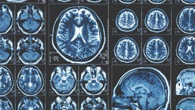 Предпосылка сканирования мозга Mri, магниторезонансная томография стоковые фото Предпосылка сканирования мозга Mri, магниторезонансная томография стоковые фото