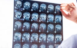 Рассмотрение мозга с MRI Доктор в снимке аварийных разверток заказа свежем мозга MRI пациентов используя коробку взгляда рентгено стоковое изображение Рассмотрение мозга с MRI Доктор в снимке аварийных разверток заказа свежем мозга MRI пациентов используя коробку взгляда рентгено стоковое изображение
