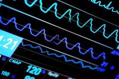 Современный монитор ICU стоковая фотография rf Современный монитор ICU стоковая фотография rf
