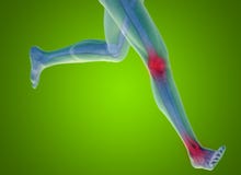 Схематическая боль анатомии человеческого тела на зеленом цвете стоковые фото Схематическая боль анатомии человеческого тела на зеленом цвете стоковые фото