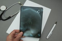 Фильм рентгеновского снимка в руках доктора, концепции стоковое изображение rf Фильм рентгеновского снимка в руках доктора, концепции стоковое изображение rf