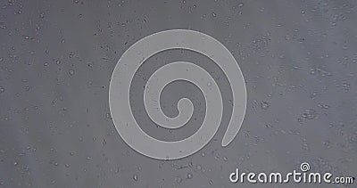 Sperm 影视素材 视频包括有剪影 宏指令 性别 医学 电池 父亲 竞争 健康 显微镜 Sperm 影视素材 视频包括有剪影 宏指令 性别 医学 电池 父亲 竞争 健康 显微镜