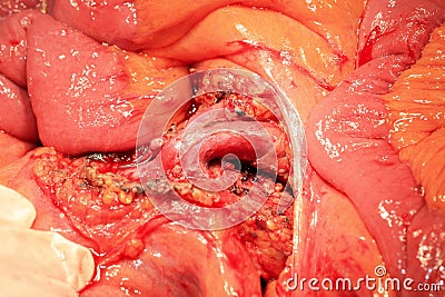 Abdominal arteries and veins Stock Photo