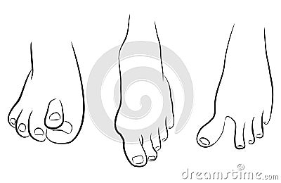 Abnormal feet Stock Photo