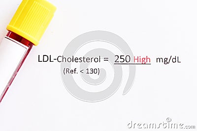 Abnormal high level LDL-cholesterol test result Stock Photo