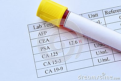 Abnormal high PSA test result Stock Photo