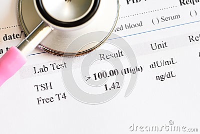 Abnormal thyroid hormone test result Stock Photo