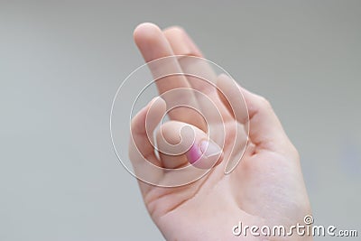 abscess on the finger. person with finger infection disease. fingernail pain. copy space. Stock Photo