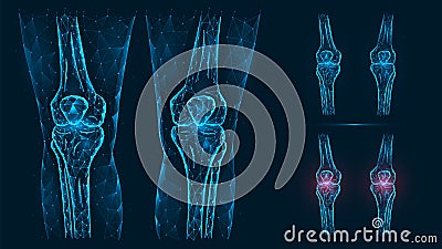 Abstract polygonal illustration of human knee anatomy. Disease, pain and inflammation of the knee joints Vector Illustration