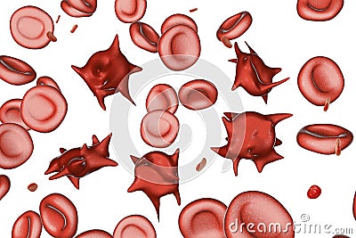 Acanthocytes, abnormal red blood cells with thorn-like projections Cartoon Illustration