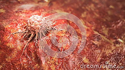 Accurate Illustration of a cancer cell - 3D Rendering Stock Photo