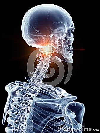 A painful cervical spine Cartoon Illustration