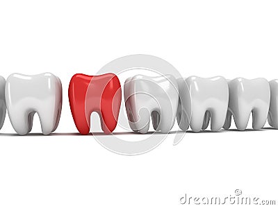 Aching tooth in row of healthy teeth Stock Photo