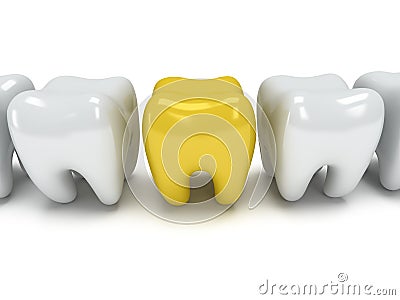 Aching tooth in row of healthy teeth Stock Photo