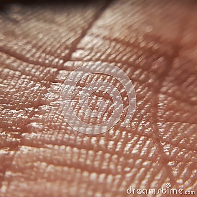 Acne concept. Skin diseases concept. macro skin of human hand.Medicine and dermatology concept. Details of human skin Stock Photo