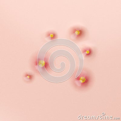 Acne pustule inflammation top view Stock Photo