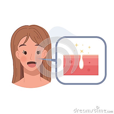 Acne treatment concept. Woman with no skin problem ,no Pimles. a Clean and clear Face. Flat vector cartoon illustration Vector Illustration