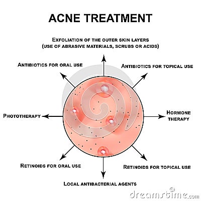 Acne treatment. Pustules, papules, comedones, blackheads, acne on the skin. Infographics. Vector illustration on Vector Illustration