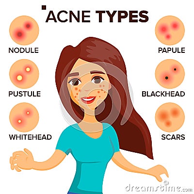 Acne Types Vector. Girl With Acne. Skin Care. Treatment, Healthy. Nodule, Whitehead. Isolated Flat Cartoon Character Vector Illustration