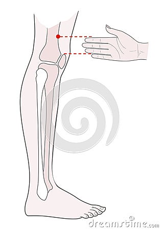 Active acupuncture points on the legs: above the knee. Vector illustration Vector Illustration