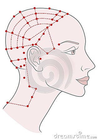 Active acupuncture points on the profile template on the back of the head. Girl with shaved bald hairless head and a beautiful Stock Photo