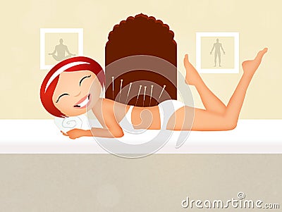 Acupuncture Stock Photo