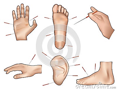 Acupuntcture vector illustration Vector Illustration