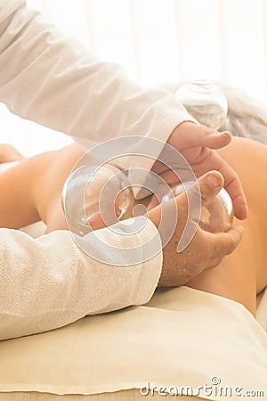 Acupunture cupping. Chinese Medicine Procedure Stock Photo