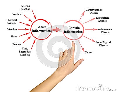 Acute and Chronic Inflammation Stock Photo