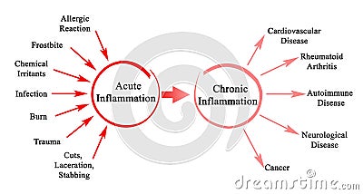 Acute and Chronic Inflammation Stock Photo