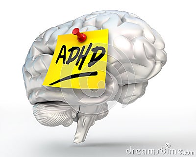 Adhd yellow note on brain Stock Photo