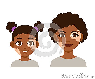 Adult and child with vitiligo Vector Illustration