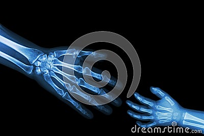 Adult help child . adult stretch out hand for grasp child hand . ( Connotation : Help orphan , Medical aid ) Stock Photo