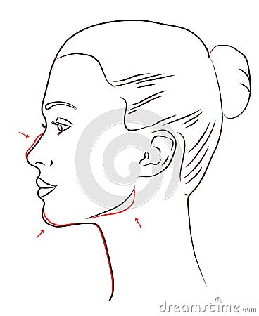 aesthetic medicine before and after of a woman's profile Cartoon Illustration