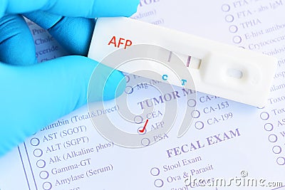 AFP positive test result by using rapid test cassette Stock Photo