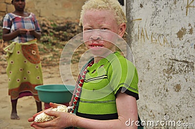 Africa albino child Editorial Stock Photo