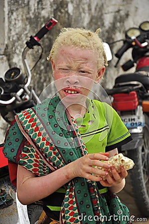 Africa albinos children portrait Editorial Stock Photo