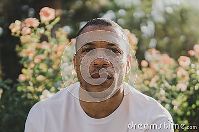 African American man with freckles outdoors looking serious Stock Photo