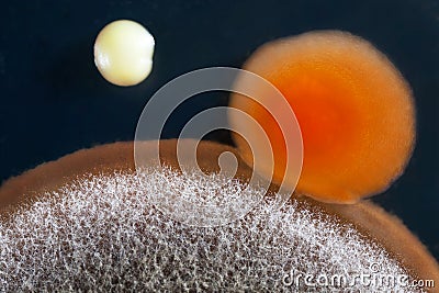 Agar culture Stock Photo