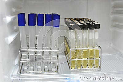 Agar in test tube rack for testing microbiology laboratory Stock Photo