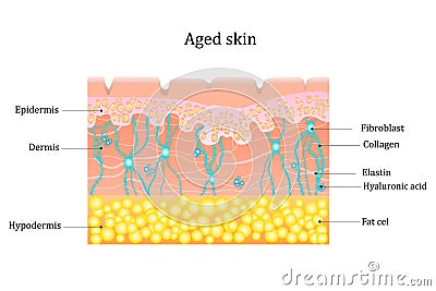 Aged skin layer. Human skin structure with collagen and elastane fibers, hyaluronic acids, fibroblasts. Schematic Cartoon Illustration