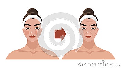 The aging process of a woman, age-related changes in the face, illustrations for a beauty salon, cosmetic procedures Vector Illustration