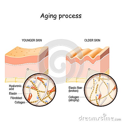 Aging process. younger and older skin. Vector Illustration