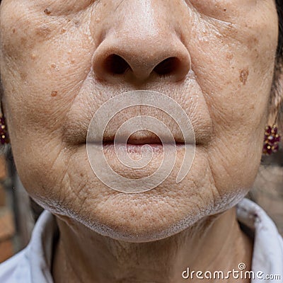 Aging skin folds or skin creases or wrinkles at face of Asian, Chinese old woman Stock Photo