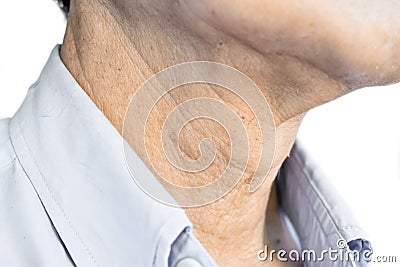 Aging skin folds or skin creases or wrinkles at neck of Asian, Chinese old man Stock Photo