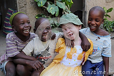 Albino child and boys in Ukerewe, Tanzania Editorial Stock Photo